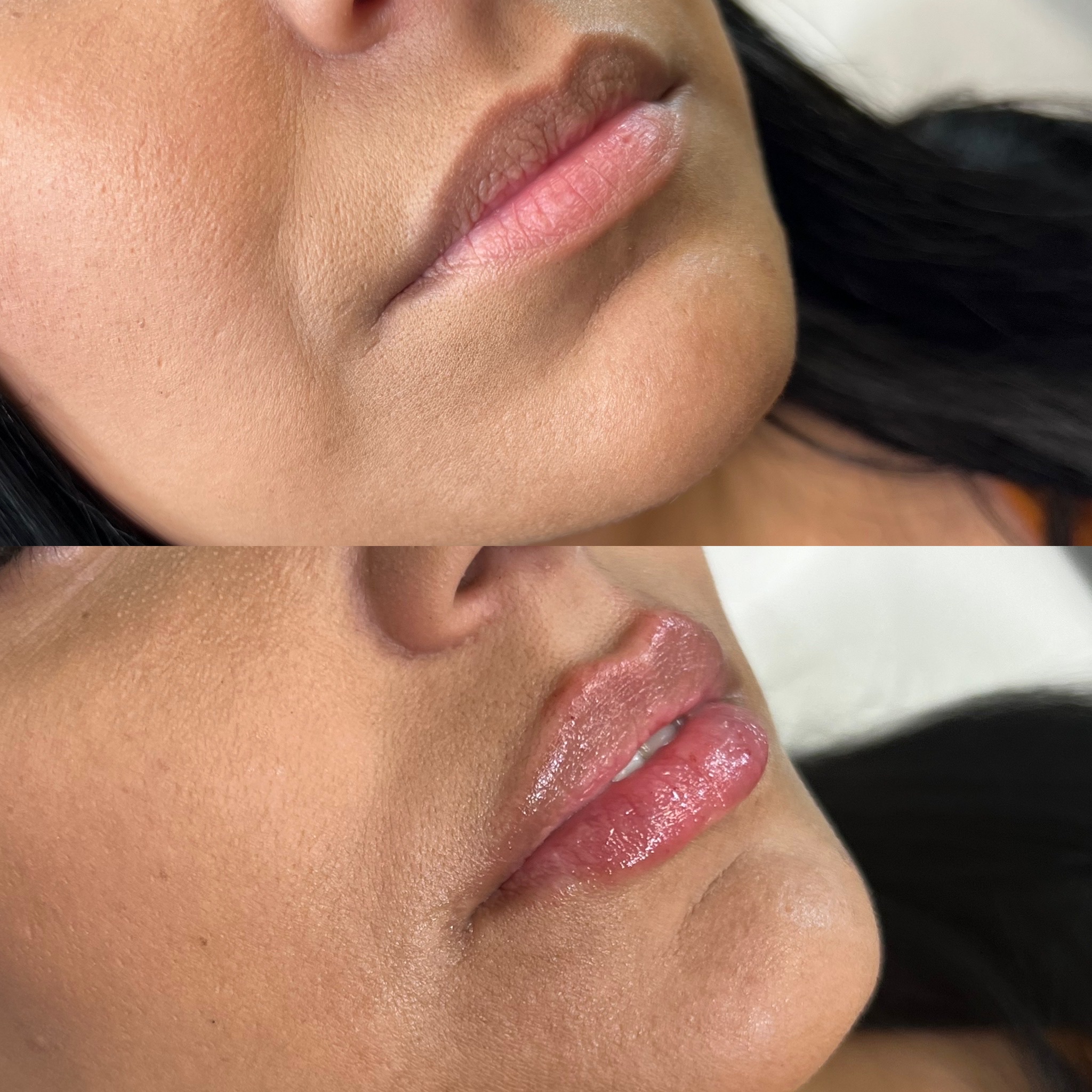 Harmonia Wellness and Aesthetics patient result 7