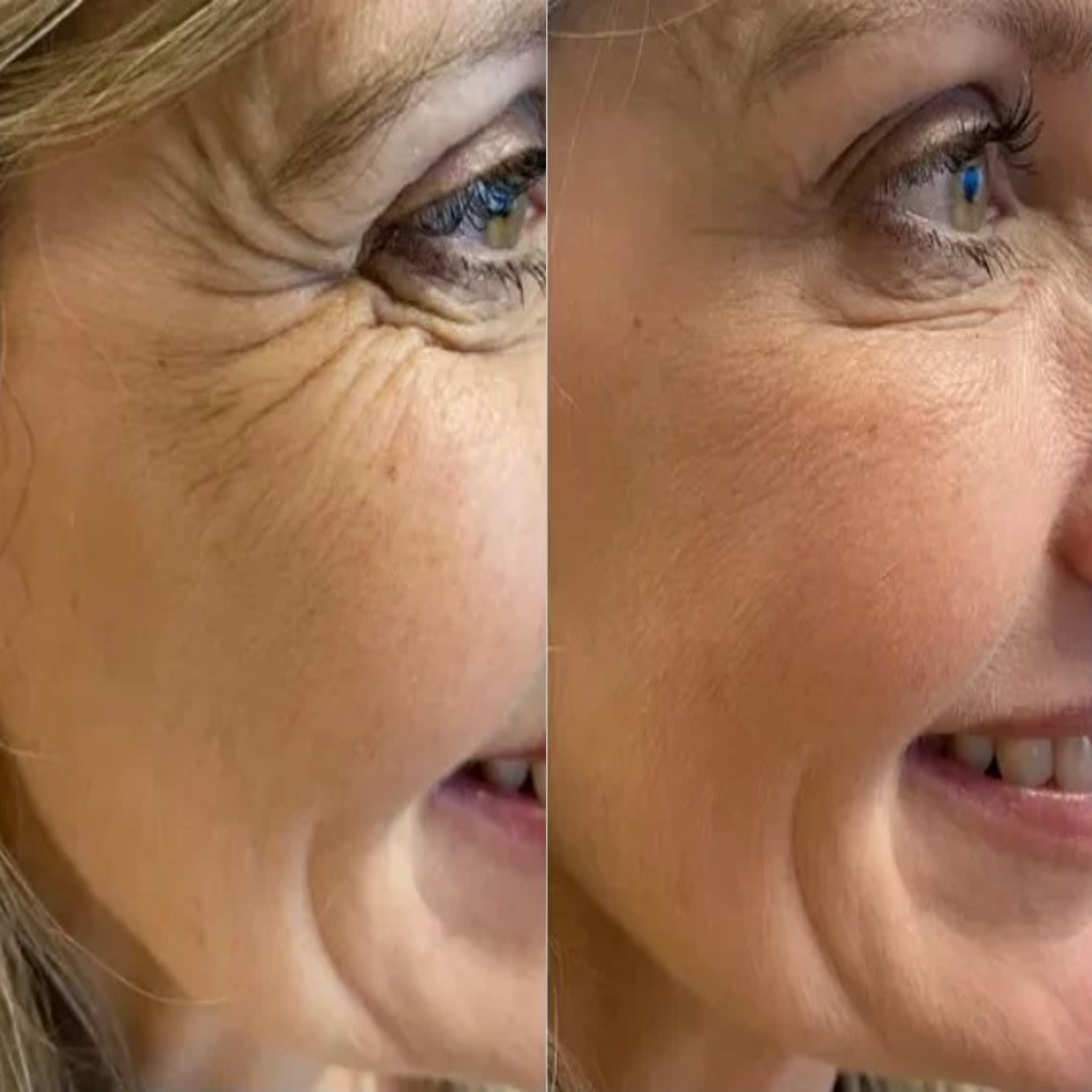 Harmonia Wellness and Aesthetics patient result 5